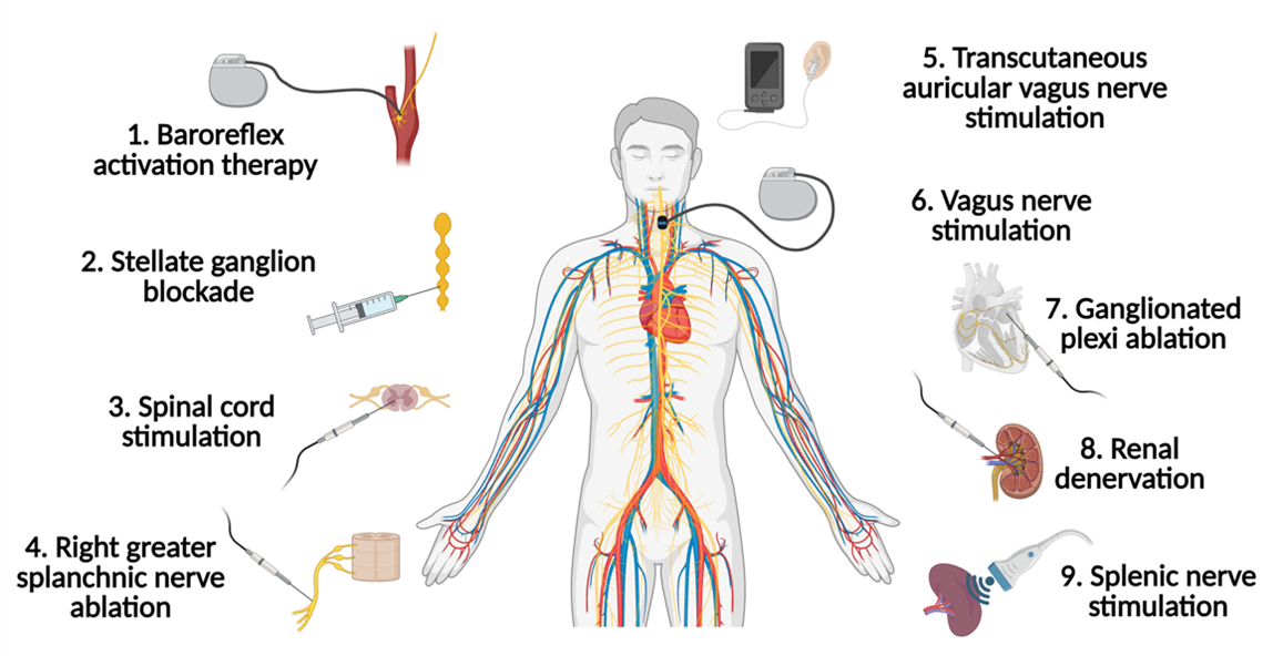 Image showing autonomic neuromodulation of heart